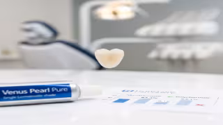 Study Confirms Simplified Layering Achieves Exceptional Aesthetic Results in Restorative Dentistry