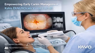 Empowering Early Caries Management with KaVo DIAGNOcam Vision Full HD